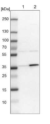 Western Blot: C21orf59 Antibody [NBP1-88277]