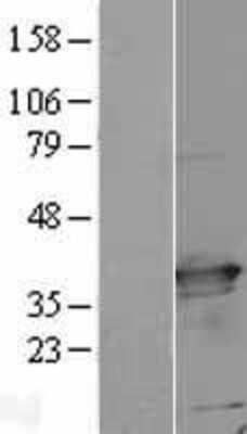 Western Blot: C21orf59 Overexpression Lysate [NBL1-08388]