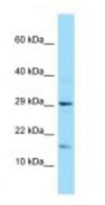 Western Blot: C21orf67 Antibody [NBP1-98259]