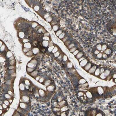 Immunohistochemistry-Paraffin: C21orf91 Antibody [NBP1-88280]