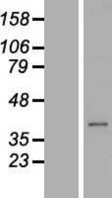 Western Blot: C21orf91 Overexpression Lysate [NBL1-08391]