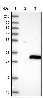 Western Blot: GUCD1 Antibody [NBP1-93512]