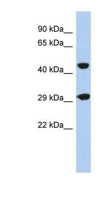 Western Blot: TANGO2 Antibody [NBP1-70463]