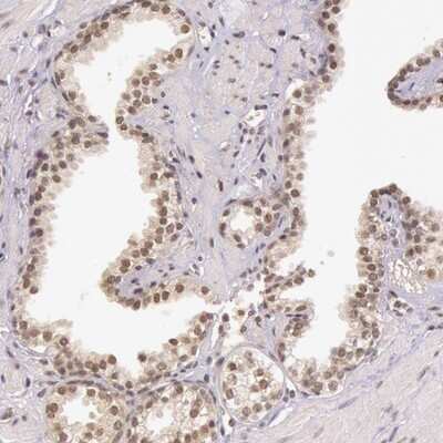 Immunohistochemistry-Paraffin: Protein Bop Antibody [NBP1-93957]