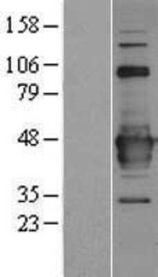 Western Blot: Protein Bop Overexpression Lysate [NBP2-06292]