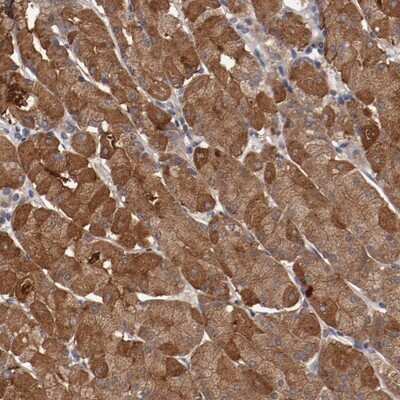 Immunohistochemistry-Paraffin: FAM211B Antibody [NBP1-93522]