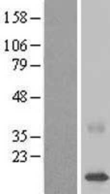 Western Blot: CDPF1 Overexpression Lysate [NBL1-08400]