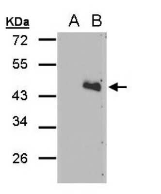 Western Blot: Aspartate Rich 1 Antibody [NBP2-15646]