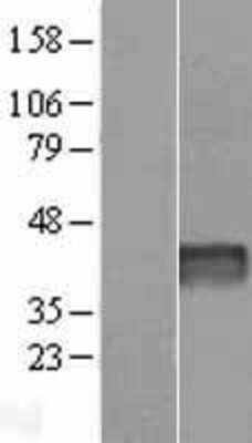 Western Blot: Aspartate Rich 1 Overexpression Lysate [NBP2-07035]