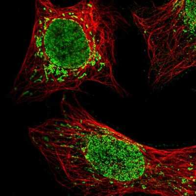 Immunocytochemistry/ Immunofluorescence: C22orf9 Antibody [NBP1-89965]