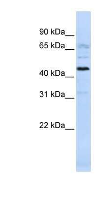 Western Blot: C22orf9 Antibody [NBP1-70465]