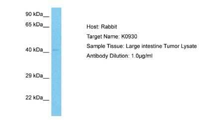 Western Blot: C22orf9 Antibody [NBP2-84552]