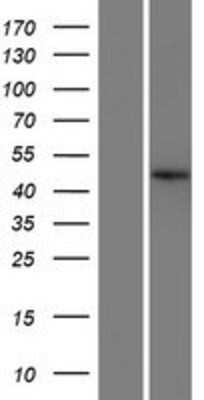 Western Blot: C22orf9 Overexpression Lysate [NBP2-10290]