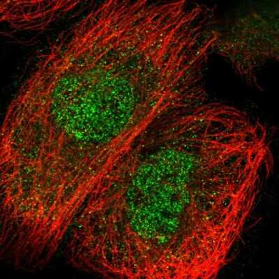 Immunocytochemistry/ Immunofluorescence: C2CD2 Antibody [NBP1-88278]