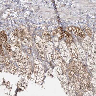 Immunohistochemistry-Paraffin: C2CD2 Antibody [NBP1-88278]