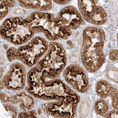 Immunohistochemistry-Paraffin: C2CD2 Antibody [NBP1-88278]