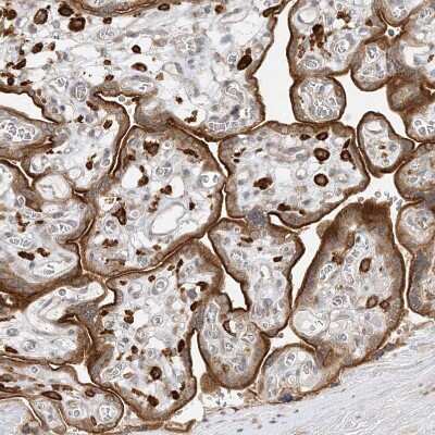Immunohistochemistry-Paraffin: C2CD2 Antibody [NBP1-88278]