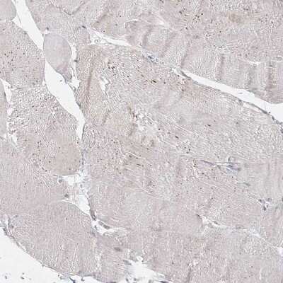 Immunohistochemistry-Paraffin: C2CD2 Antibody [NBP1-88278]