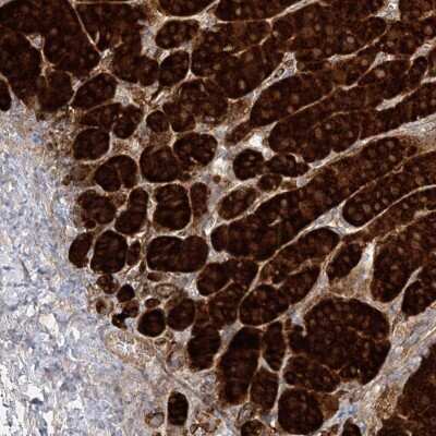 Immunohistochemistry-Paraffin: C2CD2 Antibody [NBP2-33941]