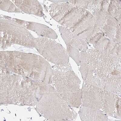 Immunohistochemistry-Paraffin: C2CD2 Antibody [NBP2-33941]