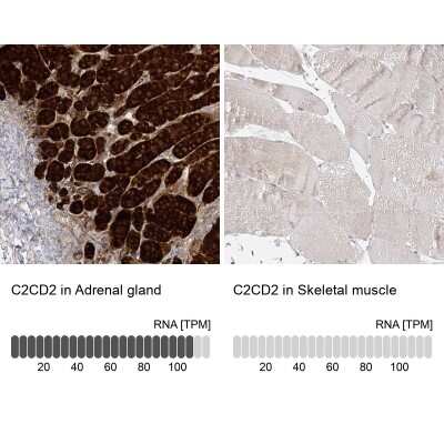 Immunohistochemistry-Paraffin: C2CD2 Antibody [NBP2-33941]