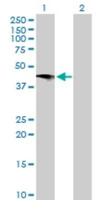 Western Blot: C2CD2 Antibody [H00025966-B01P]