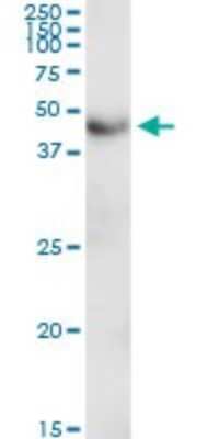 Western Blot: C2CD2 Antibody [H00025966-D01P]