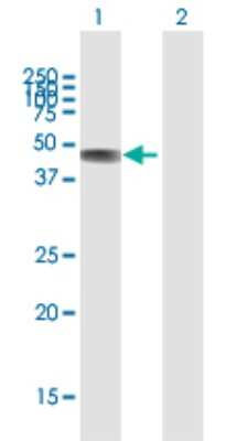 Western Blot: C2CD2 Antibody [H00025966-D01P]