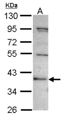 Western Blot: C2CD2 Antibody [NBP2-15647]