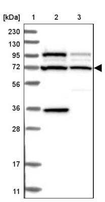 Western Blot: C2CD2 Antibody [NBP2-33941]