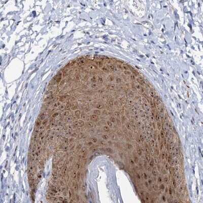 Immunohistochemistry: C2CD3 Antibody [NBP2-38416]