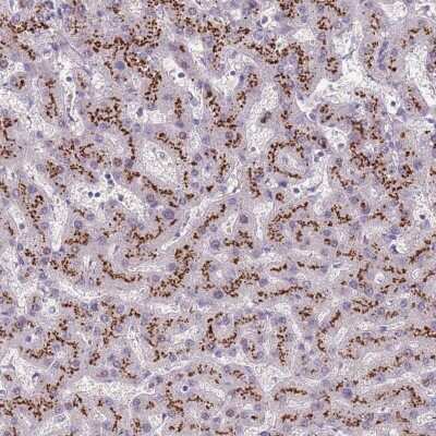 Immunohistochemistry: C2CD3 Antibody [NBP2-38466]