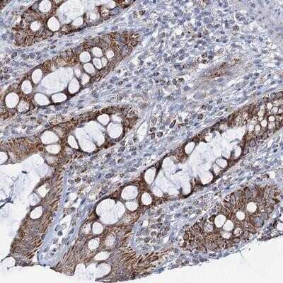 Immunohistochemistry-Paraffin: C2CD3 Antibody [NBP1-94074]