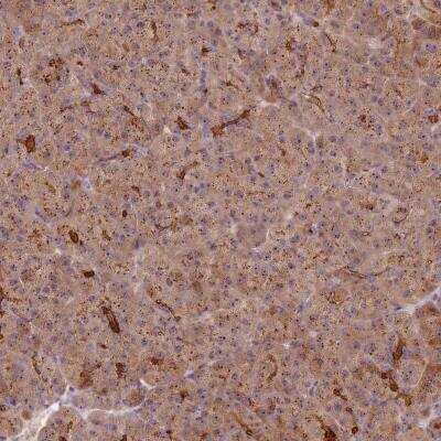 Immunohistochemistry-Paraffin: C2CD4B Antibody [NBP1-94053]