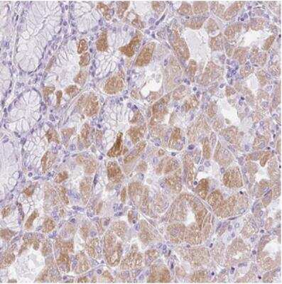 Immunohistochemistry: C2CD4C Antibody [NBP2-30575]