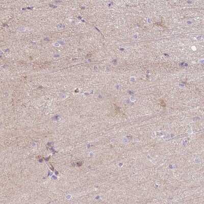 Immunohistochemistry-Paraffin: C2CD4C Antibody [NBP2-30575]