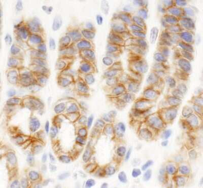Immunohistochemistry: C2CD5 Antibody [NB100-74596]