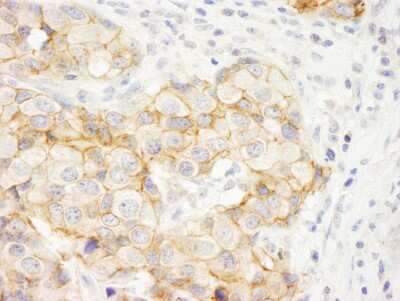 Immunohistochemistry: C2CD5 Antibody [NB100-74596]
