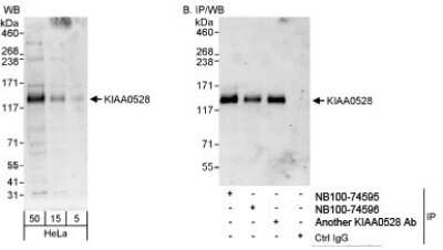 Western Blot: C2CD5 Antibody [NB100-74596]