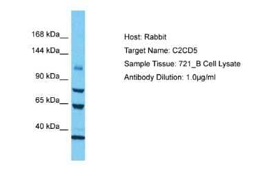 Western Blot: C2CD5 Antibody [NBP2-87101]