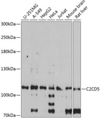 Western Blot: C2CD5 AntibodyAzide and BSA Free [NBP2-92738]