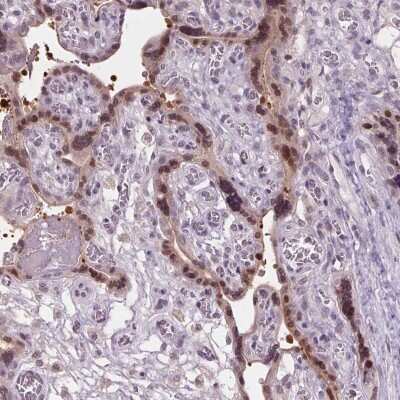 Immunohistochemistry-Paraffin: C2orf16 Antibody [NBP2-38814]