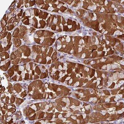 Immunohistochemistry-Paraffin: C2orf16 Antibody [NBP2-14763]