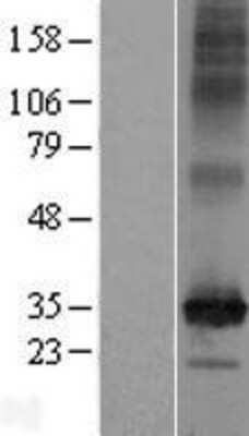 Western Blot: SLC35F6 Overexpression Lysate [NBP2-06909]