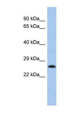 Western Blot: C2orf27B Antibody [NBP1-56812]