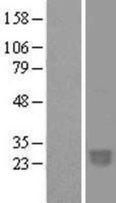 Western Blot: C2orf27B Overexpression Lysate [NBL1-13081]