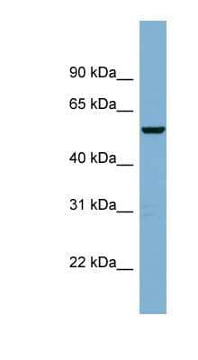 Western Blot: CNOT11 Antibody [NBP1-56529]