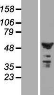 Western Blot: CNOT11 Overexpression Lysate [NBL1-08408]