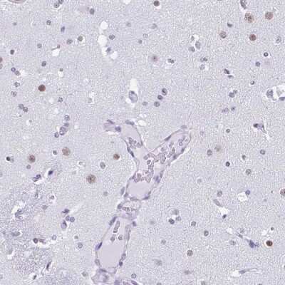 Immunohistochemistry-Paraffin: D-Glutamate Cyclase Antibody [NBP2-30590]