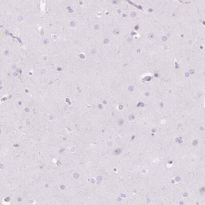 Immunohistochemistry-Paraffin: D-Glutamate Cyclase Antibody [NBP2-30715]